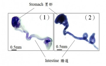 香港大學(xué)李嘉誠(chéng)醫(yī)學(xué)院發(fā)現(xiàn)影響腸神經(jīng)細(xì)胞發(fā)育的新基因變異